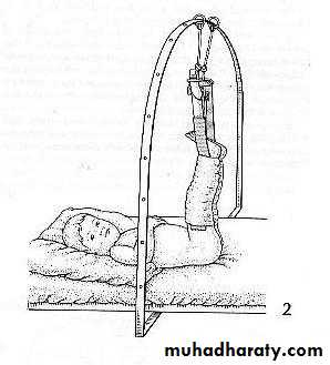 Orthopedics Principle of Fractures