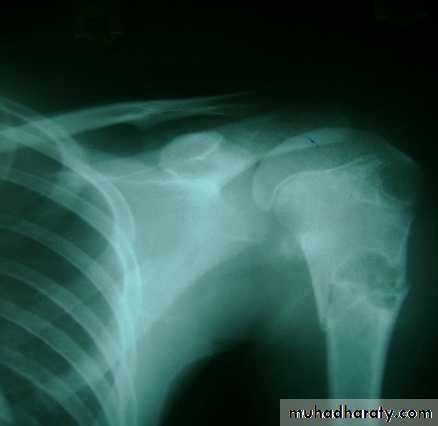 Orthopedics Principle of Fractures