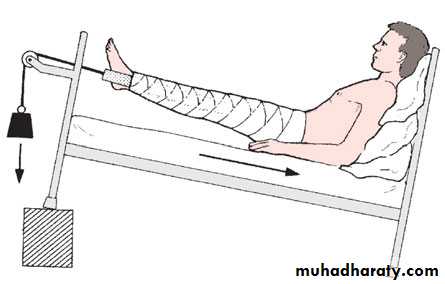 Orthopedics Principle of Fractures