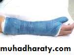 Orthopedics Principle of Fractures