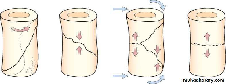 Orthopedics Principle of Fractures