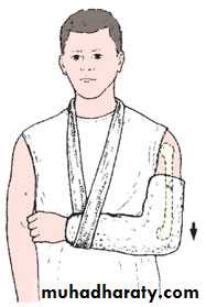 Orthopedics Principle of Fractures