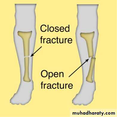 Orthopedics Principle of Fractures