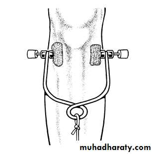 Orthopedics Principle of Fractures