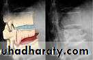 Orthopedics Principle of Fractures