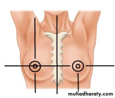 Breast Diseases