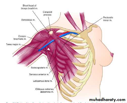 Breast Diseases