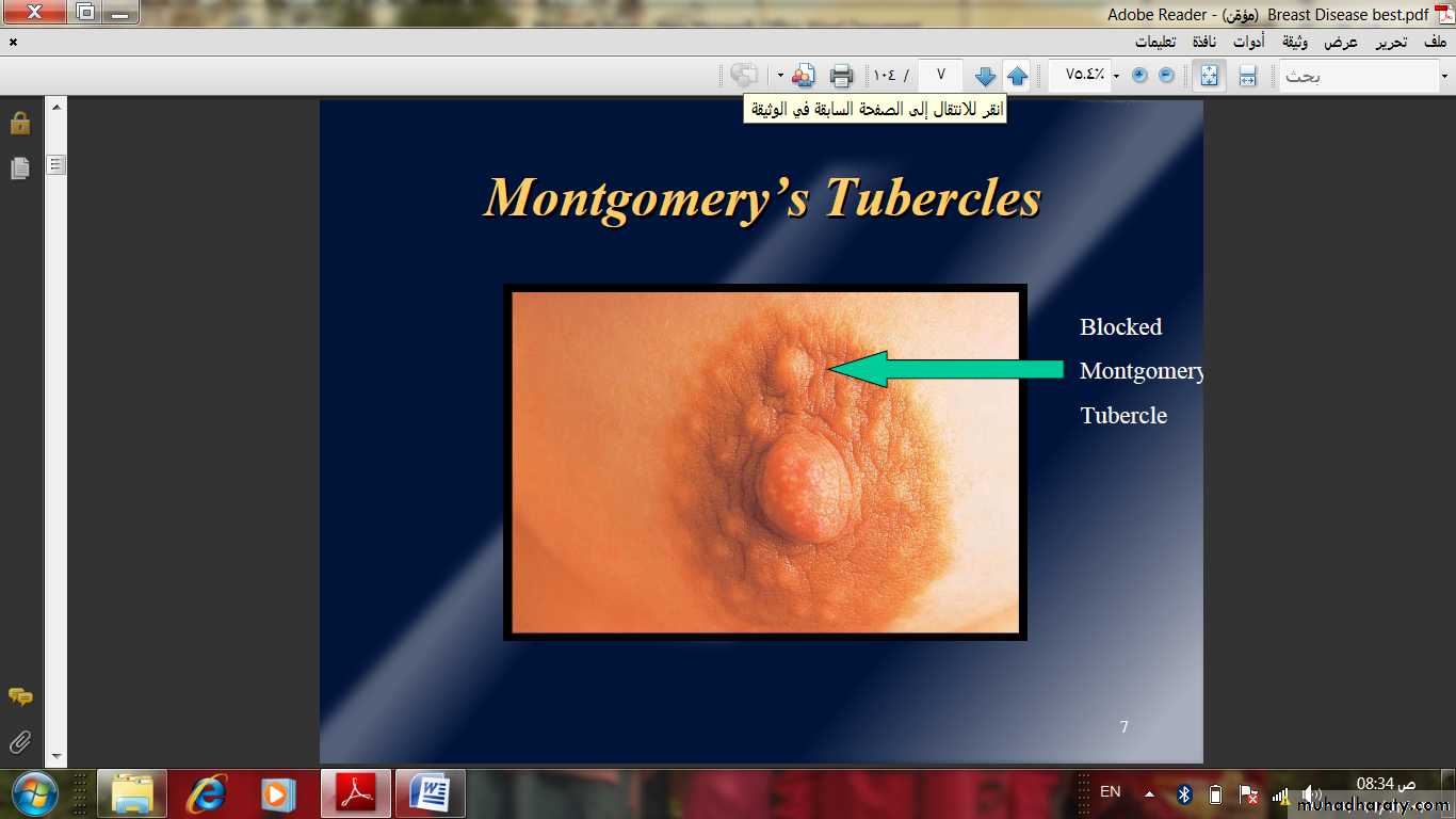Breast Diseases