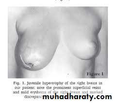 Breast Diseases