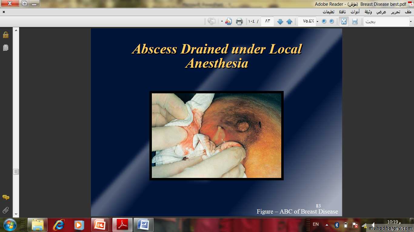 Breast Diseases