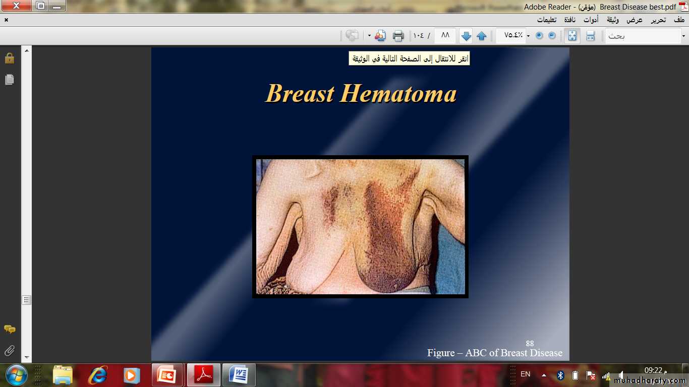 Breast Diseases