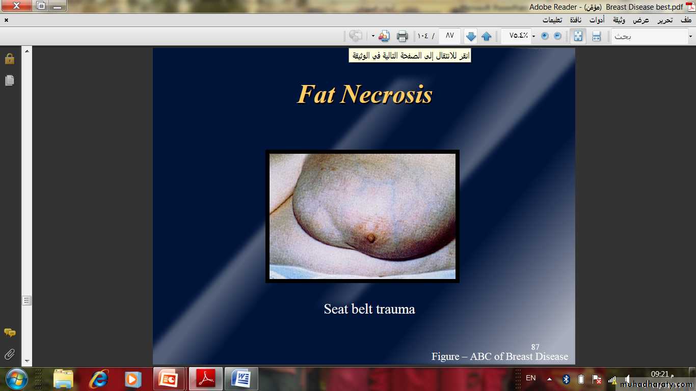Breast Diseases