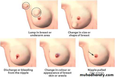 Breast Diseases