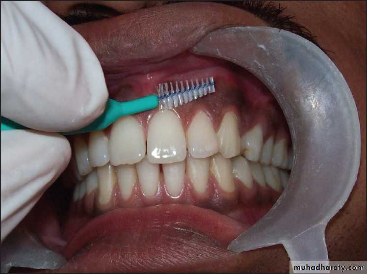 biopsy