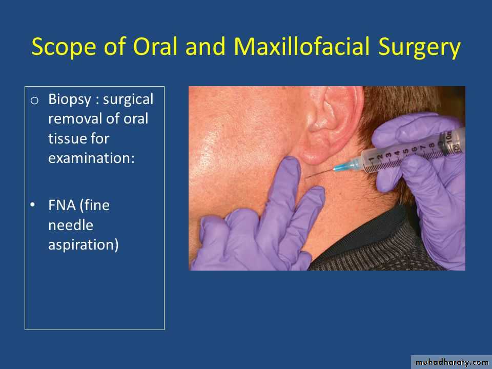biopsy