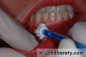 biopsy