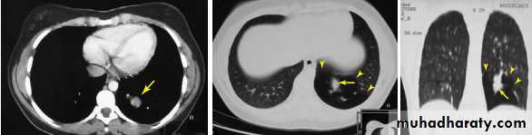 Introduction to Xray and CT