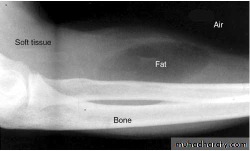 Introduction to Xray and CT
