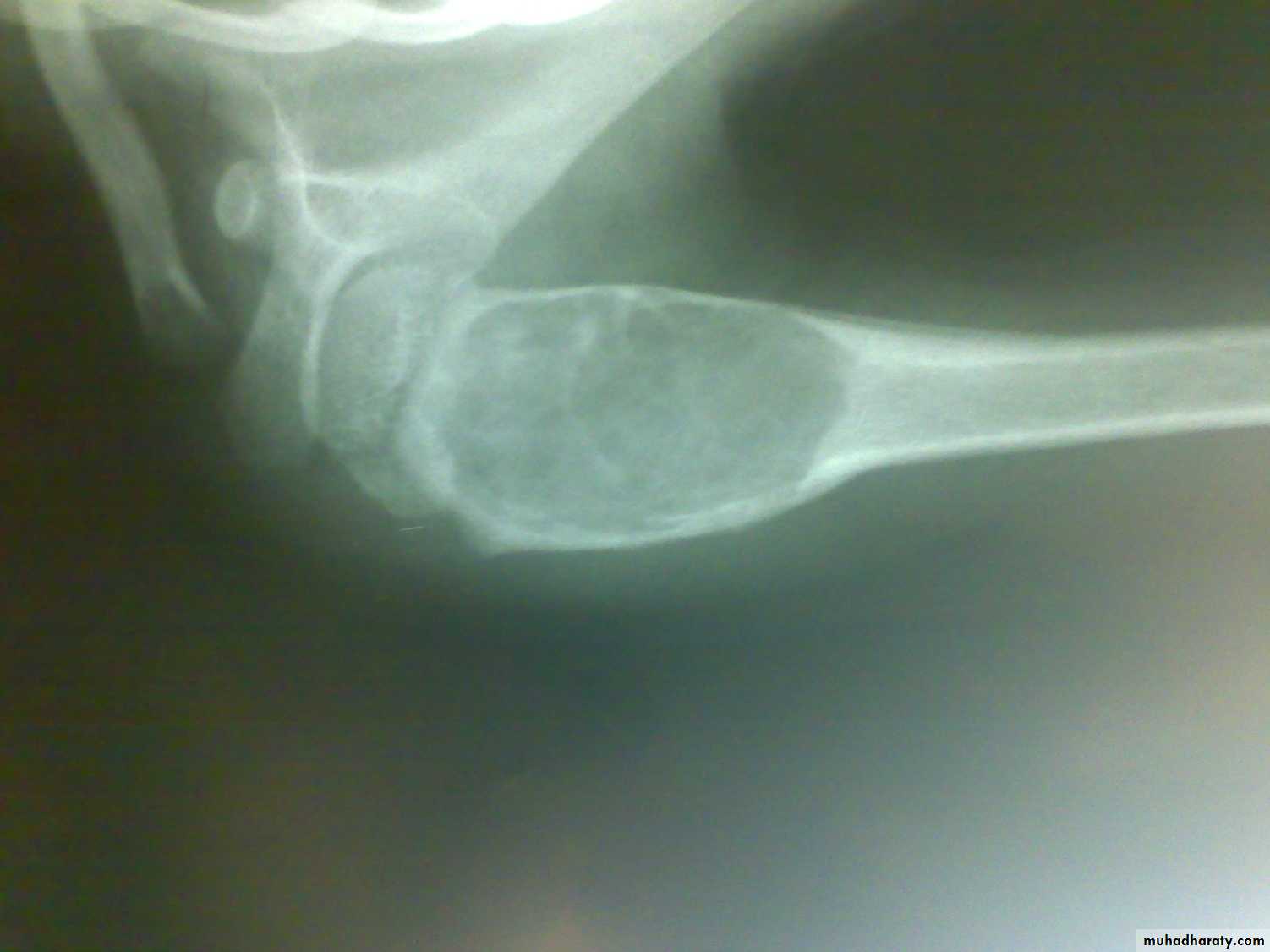 Orthopedics introduction
