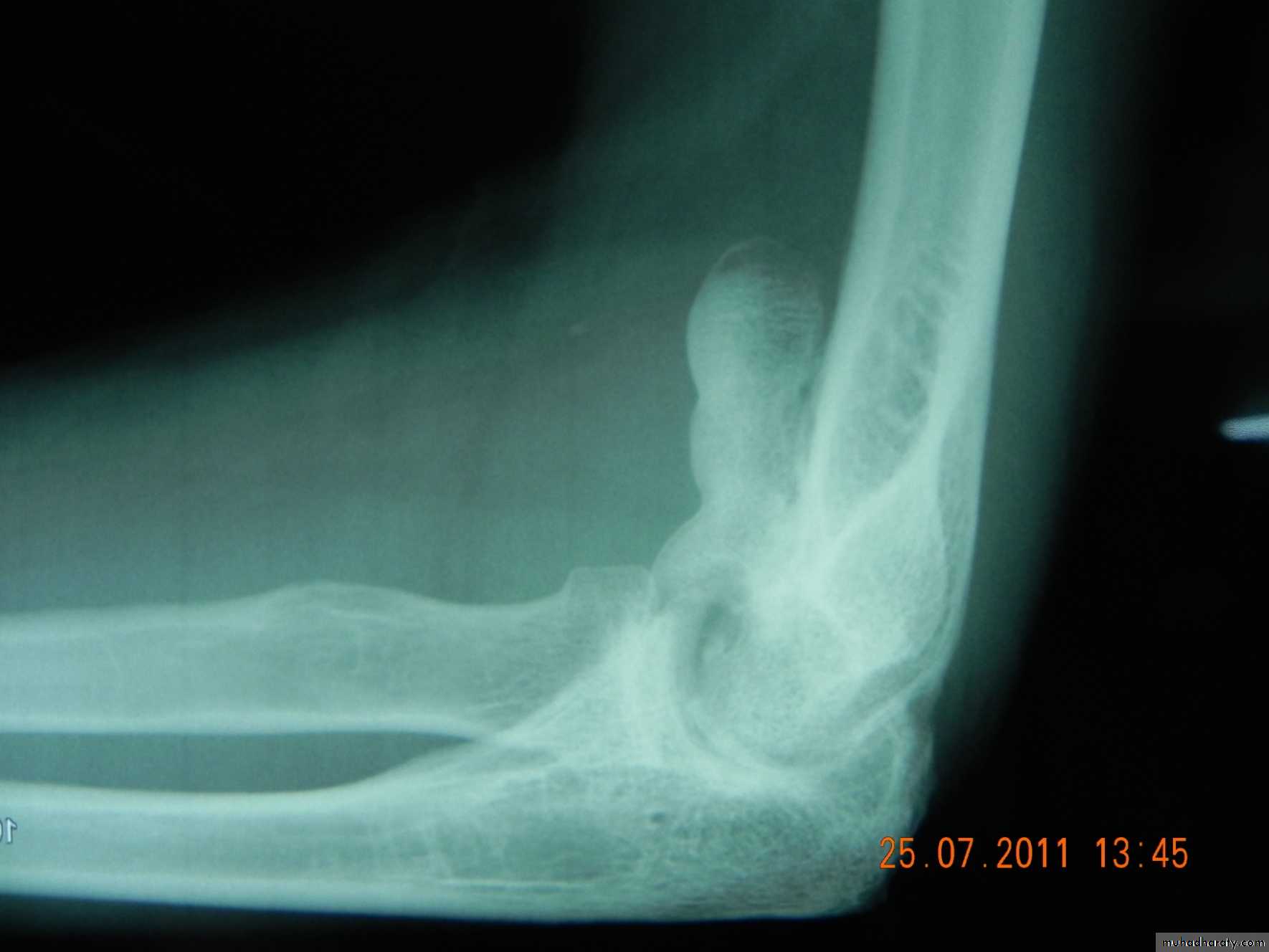 Orthopedics introduction