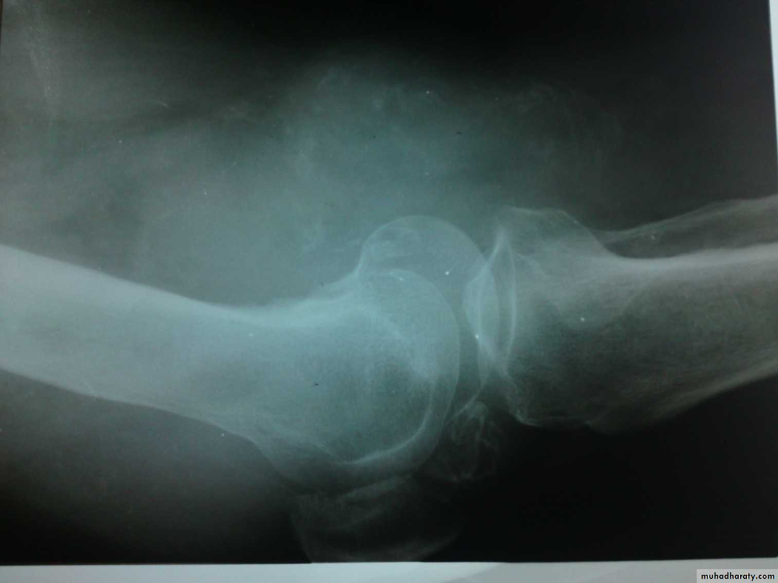 Orthopedics introduction
