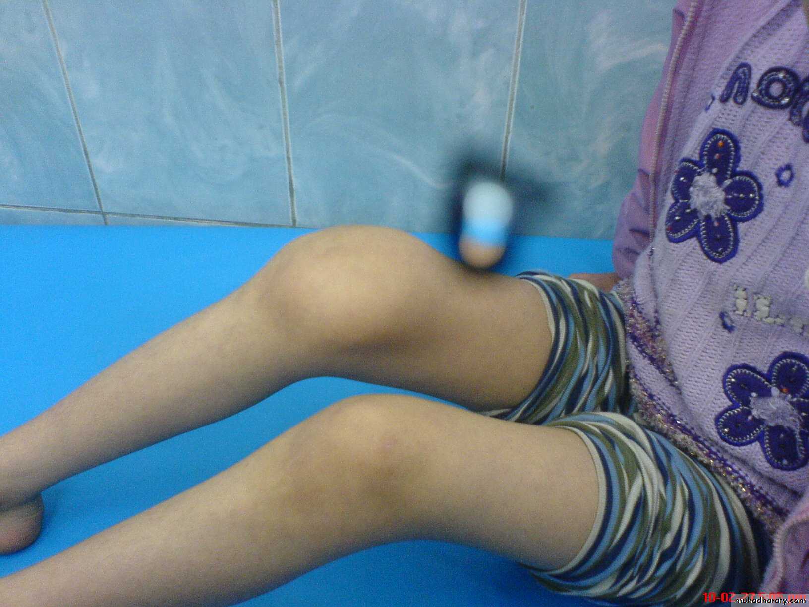 Orthopedics introduction