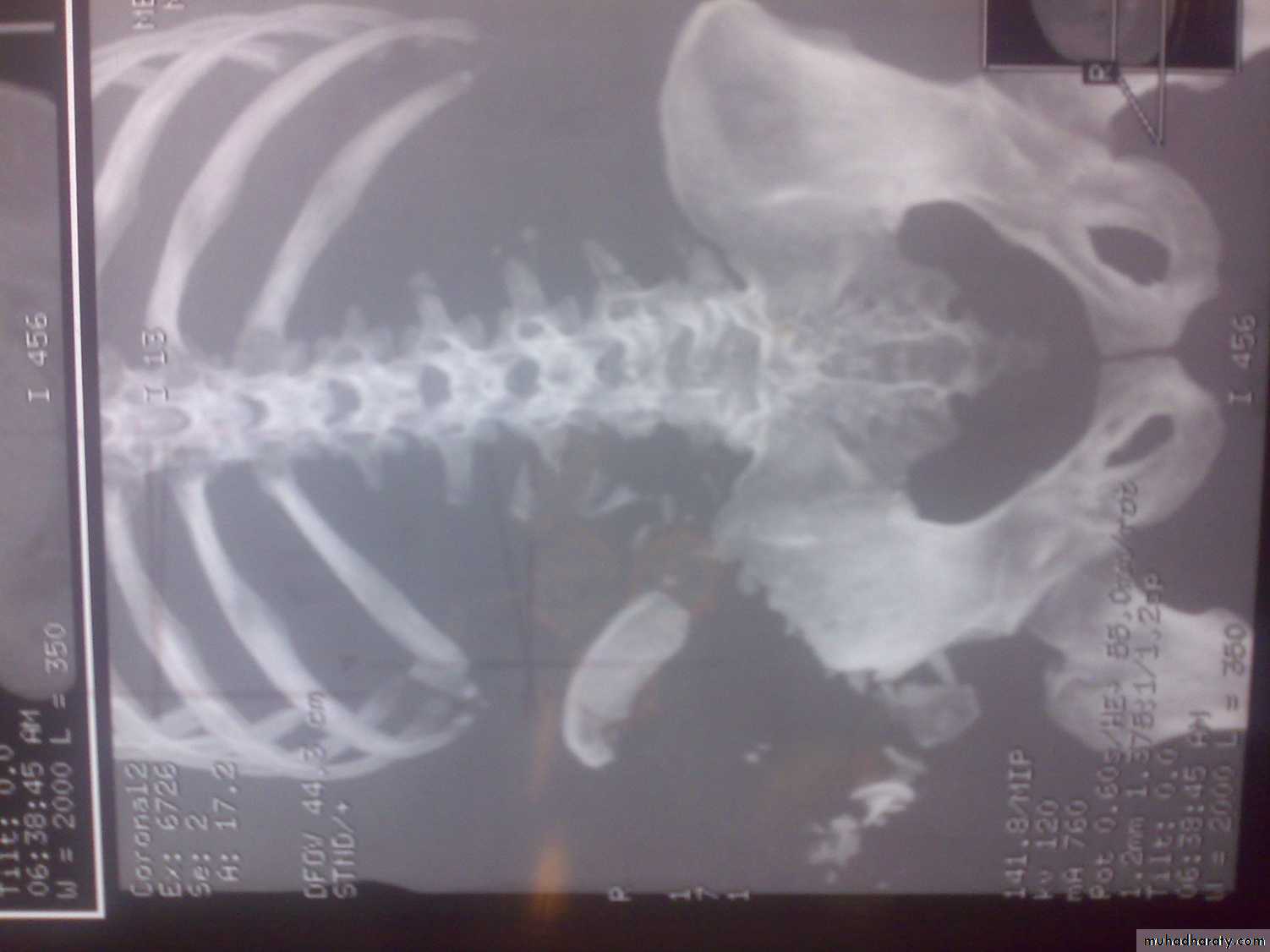 Orthopedics introduction