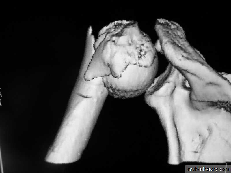 Orthopedics introduction