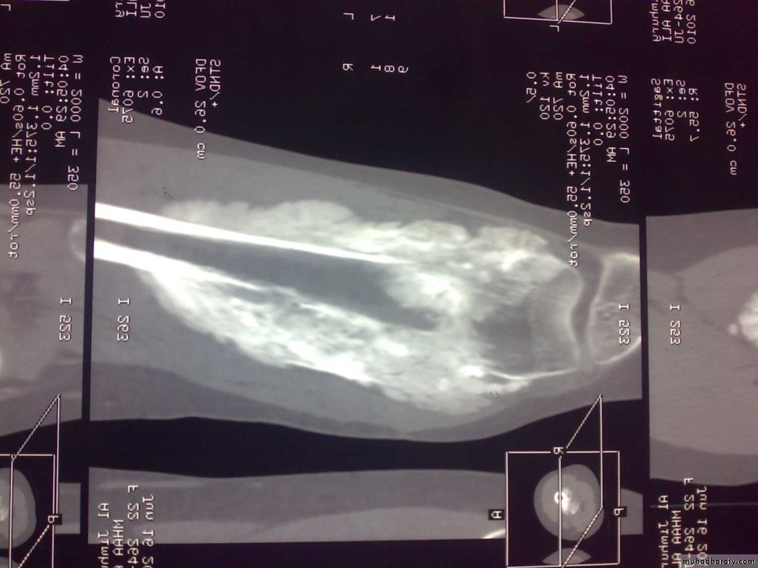 Orthopedics introduction