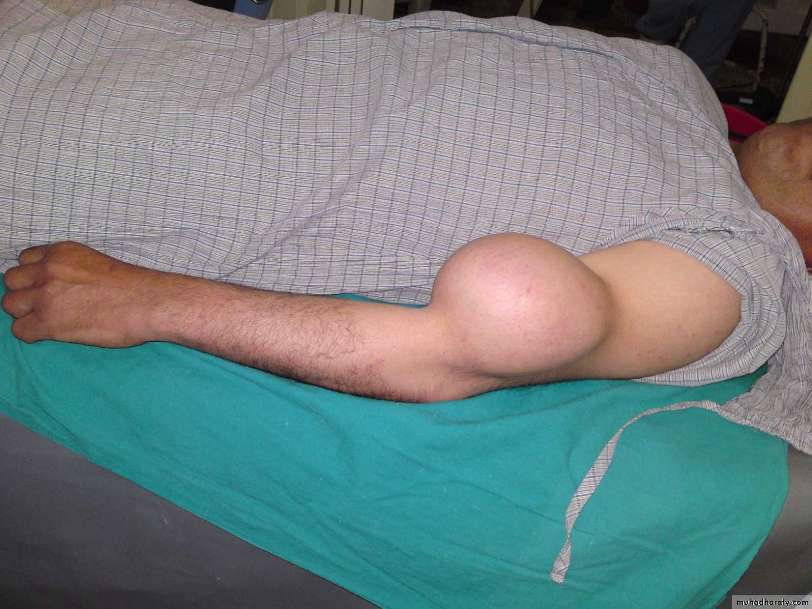 Orthopedics introduction