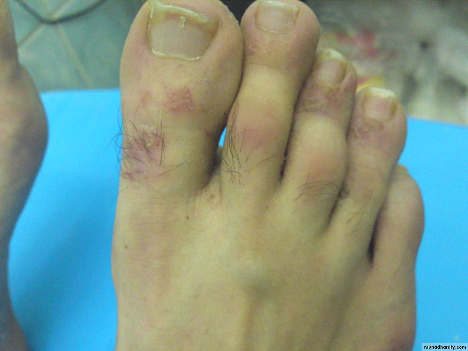 Orthopedics introduction