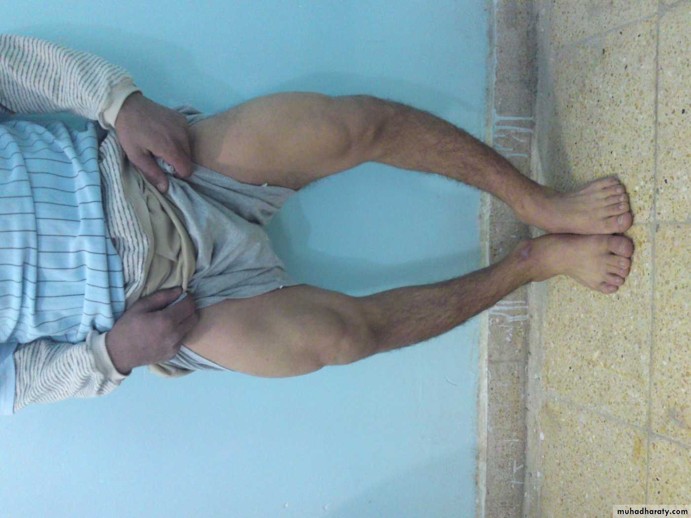 Orthopedics introduction
