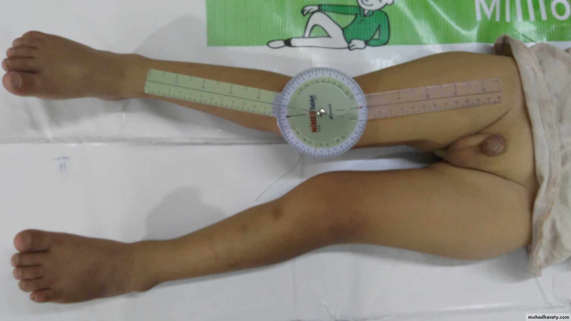 Orthopedics introduction