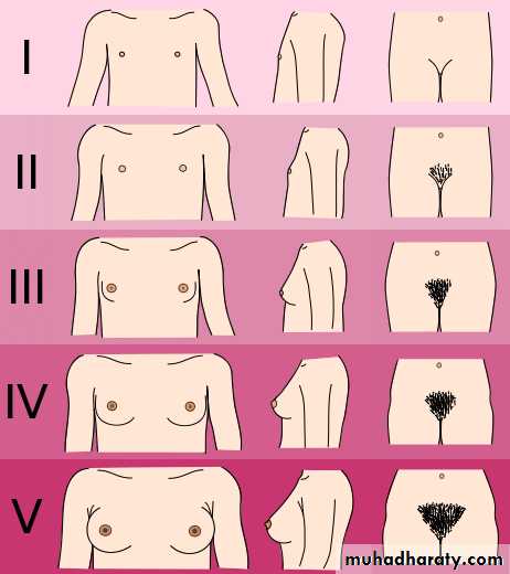 delayed puberty