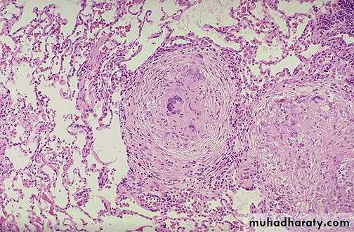 Chronic inflammation