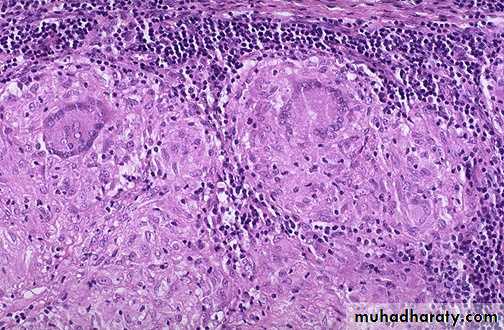 Chronic inflammation
