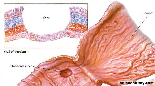 Chronic inflammation