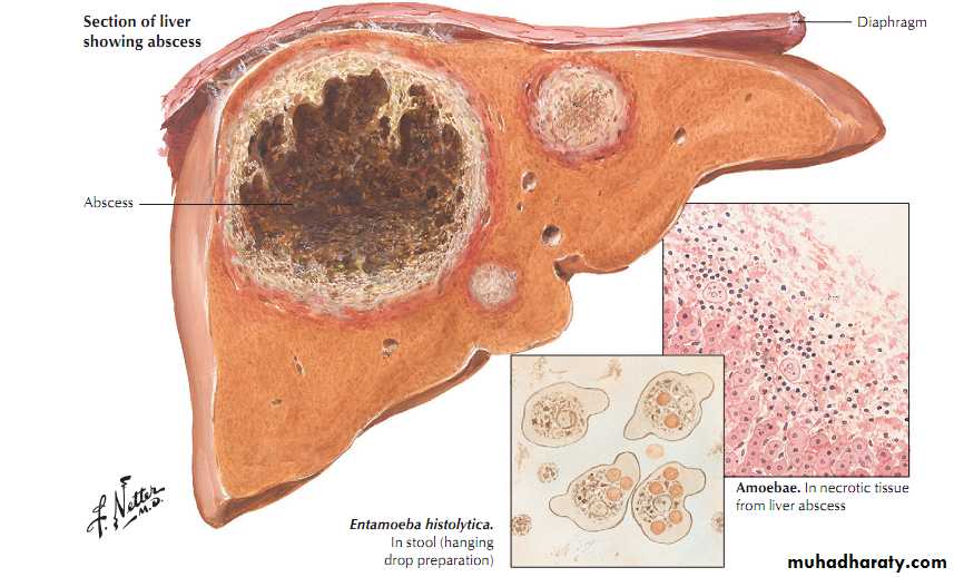 Chronic inflammation