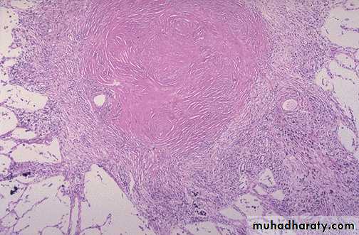 Chronic inflammation
