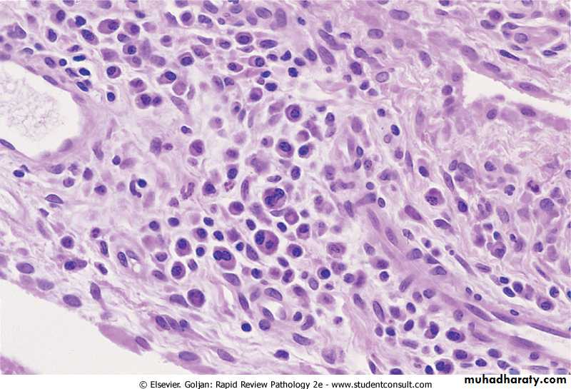 Chronic inflammation