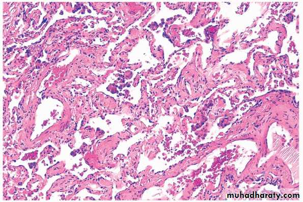 Chronic inflammation