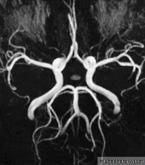Skull X-Rays