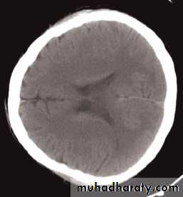 Skull X-Rays