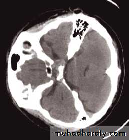 Skull X-Rays