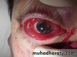 General Management Of Facial Injuries power point