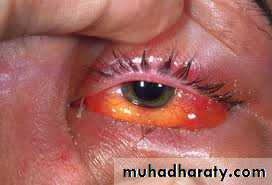 General Management Of Facial Injuries power point