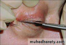 General Management Of Facial Injuries power point