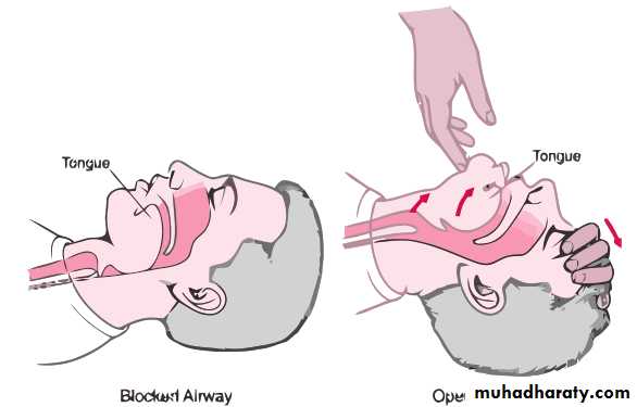 General Management Of Facial Injuries power point