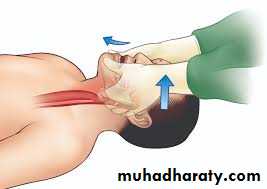 General Management Of Facial Injuries power point