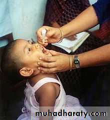 Poliomyelitis